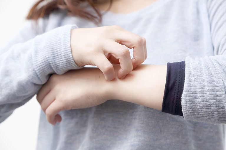 湿疹・かぶれとは